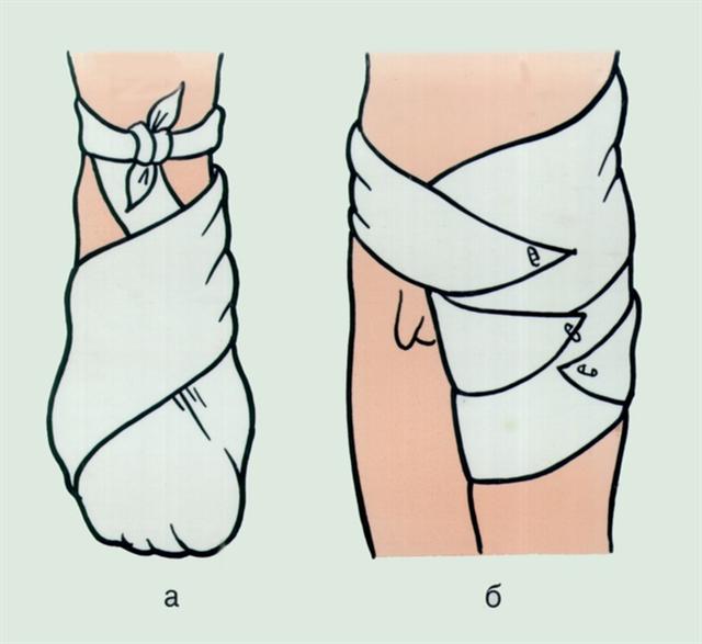 Повязки. Использование треугольной косынки