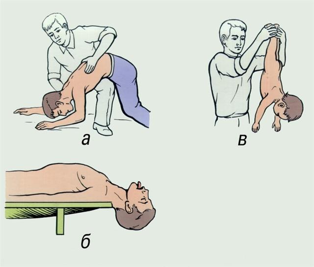 Удаление инородного тела из дыхательных путей