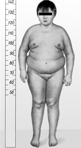 Юноша 16 лет с патологической феминизацией