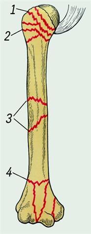 Плечо. Варианты типичных переломов