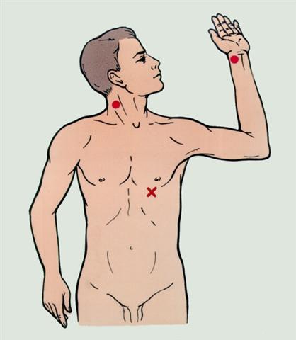 Реанимация. Точки определения пульса на артериях и место выслушивания тонов сердца