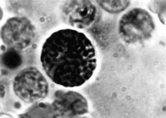 Микропретраты неизмененного базофила при базофильном тесте