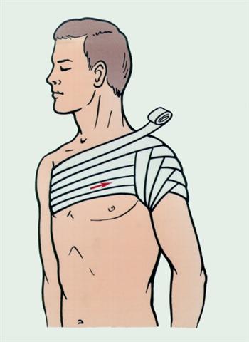 Плечевой сустав. Колосовидная повязка