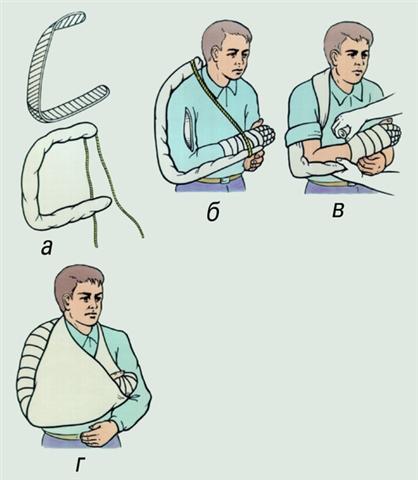 Локтевой сустав. Иммобилизация при повреждениях плеча и локтевого сустава