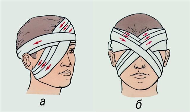 Глаз. Наложение повязки