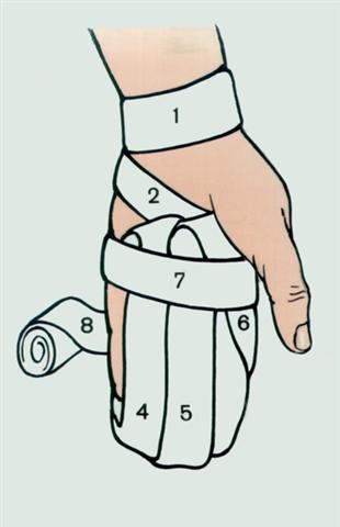 Кисть. Возвращающаяся повязка