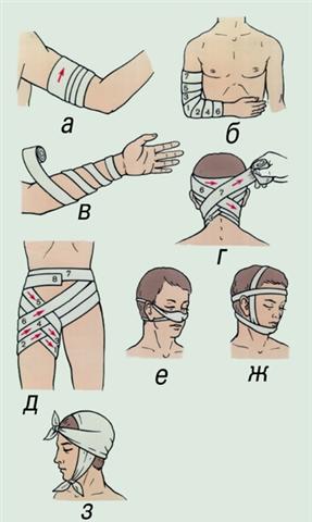 Повязки. Различные типы бинтовых повязок