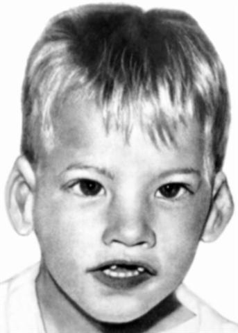 Ребенок с синдромом Лежена возрасте 4 лет