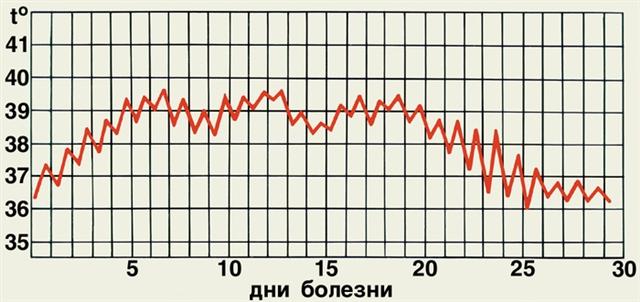 Температурная кривая при брюшном тифе