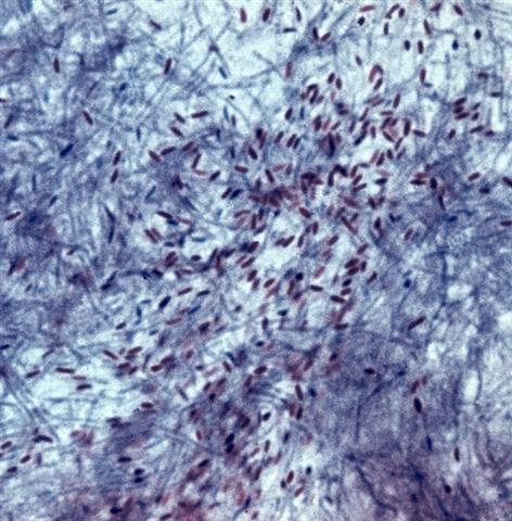 Чистая культура Bacillus cereus