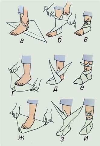 Стопа. Наложение косыночной повязки на пятку