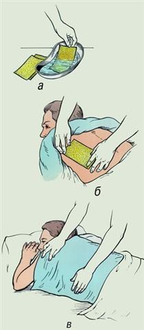 Горчичники. Последовательность наложения