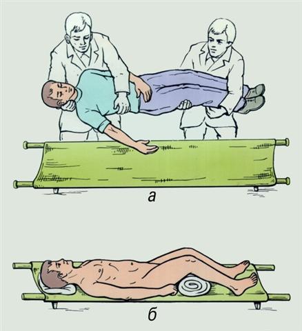 Таз. Этапы укладывания пострадавшего с переломом костей таза