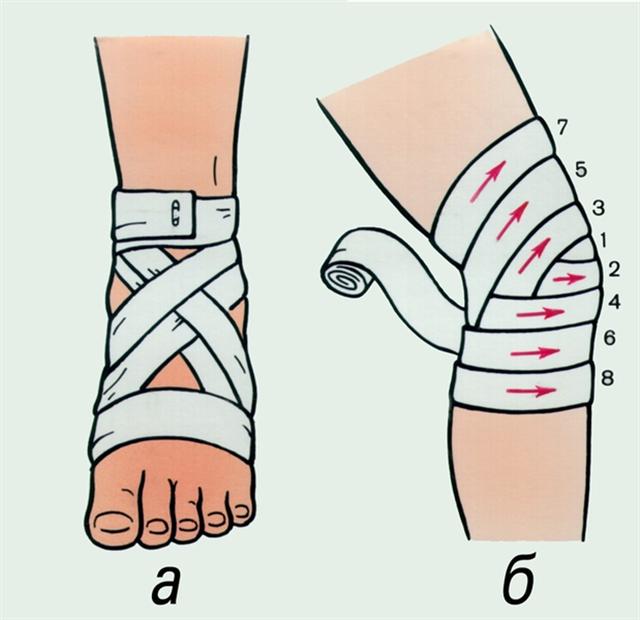 Повязки. Крестообразные повязки на голеностопный и коленный суставы