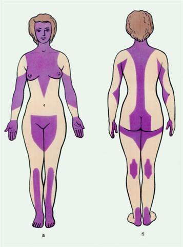 Зоны тела человека, где не следует производить инъекции