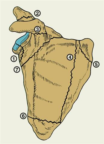 Схема переломов лопатки