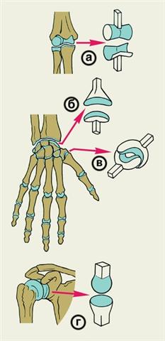 Схематическое изображение суставов с различной формой суставных поверхностей