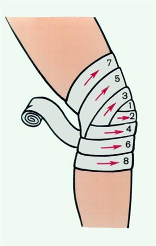 Коленный сустав. Бинтовая повязка