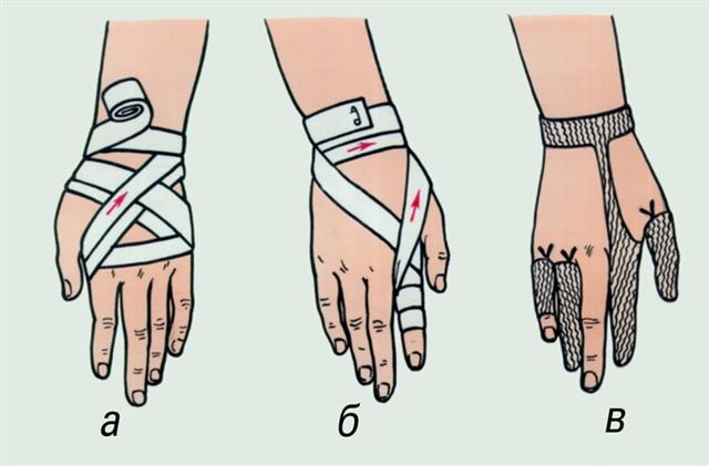 Кисть. Повязки