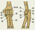 Изображение к статье Локтевой сустав