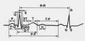 Изображение к статье Электрокардиография