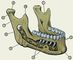 Изображение к статье Челюсти