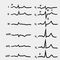 Изображение к статье Электрокардиография